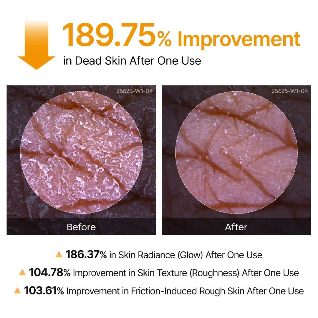 🔥Back In Stock 🏆 AQA Keratin Care Kojic Acid & Turmeric Exfoliating Body Spray 200ml