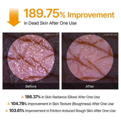 🔥Back In Stock 🏆 AQA Keratin Care Kojic Acid & Turmeric Exfoliating Body Spray 200ml